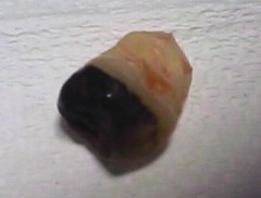 露出していた部分がことごとく虫歯に冒されていた。
